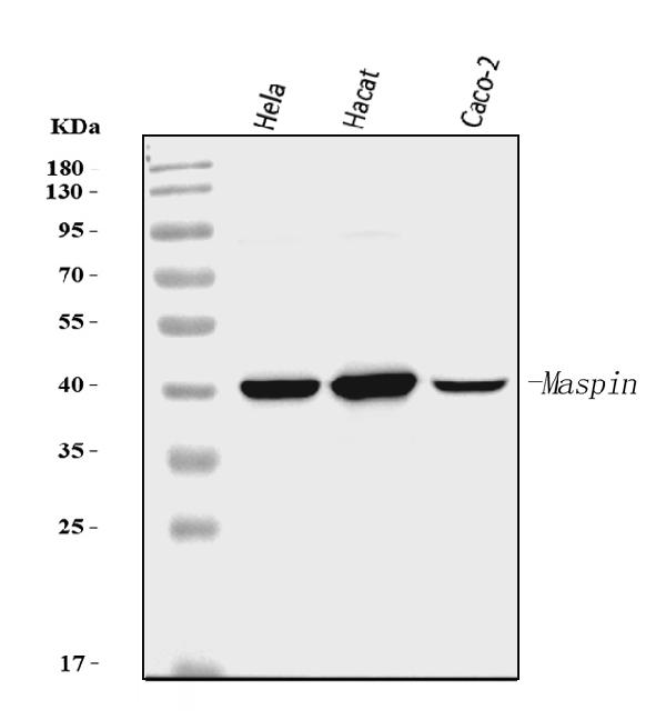 1 - Anti-MASPIN Antibody Picoband™ (monoclonal, 7G4E1) ABO16256