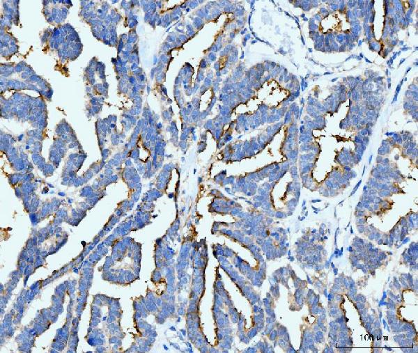 2 - Anti-ICAM1 Antibody Picoband™ (monoclonal, 6F2C3) ABO16259