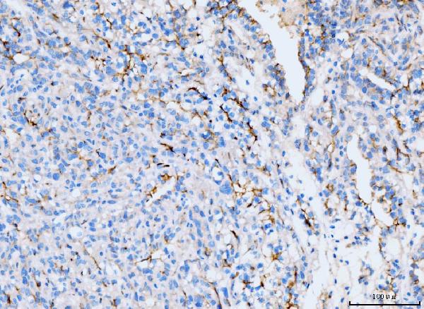 2 - Anti-ICAM1 Antibody Picoband™ (monoclonal, 6F2C3) ABO16259