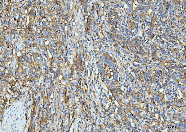 2 - Anti-ICAM1 Antibody Picoband™ (monoclonal, 6F2C3) ABO16259