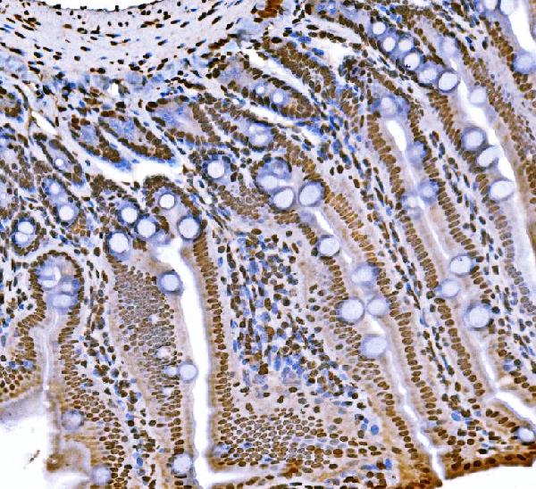 2 - Anti-Histone H1.0/H1F0 Antibody Picoband™ (monoclonal, 5I3E6) ABO16260