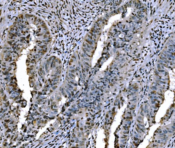 2 - Anti-Histone H1.0/H1F0 Antibody Picoband™ (monoclonal, 5I3E6) ABO16260