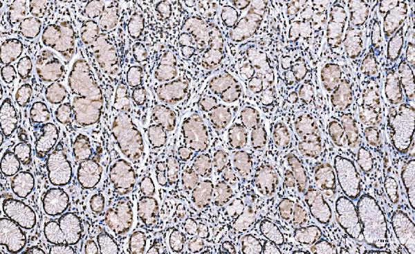 2 - Anti-Histone H1.0/H1F0 Antibody Picoband™ (monoclonal, 5I3E6) ABO16260