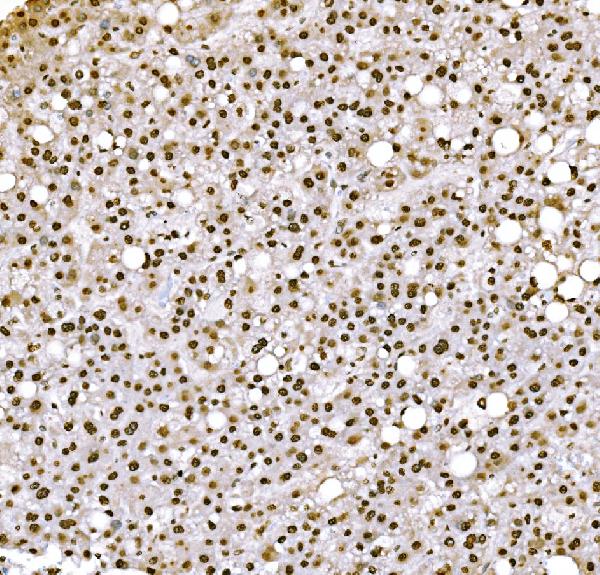 2 - Anti-Histone H1.0/H1F0 Antibody Picoband™ (monoclonal, 5I3E6) ABO16260