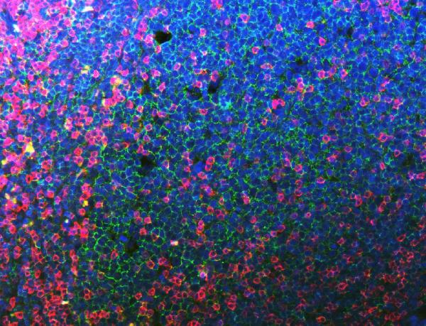 3 - Anti-CD20 Antibody Picoband™ (monoclonal, 4D11) ABO16261
