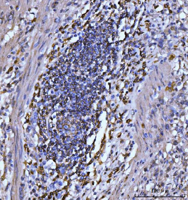 2 - Anti-CD20 Antibody Picoband™ (monoclonal, 4D11) ABO16261