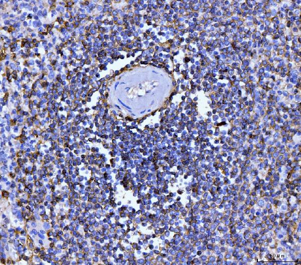 2 - Anti-CD20 Antibody Picoband™ (monoclonal, 4D11) ABO16261