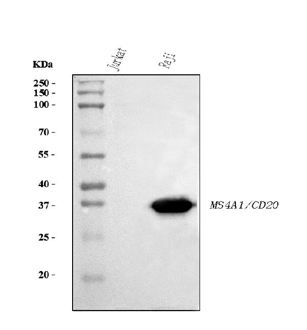 1 - Anti-CD20 Antibody Picoband™ (monoclonal, 4D11) ABO16261