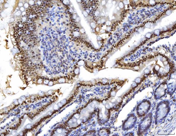 2 - Anti-HNF-4-alpha Antibody Picoband™ (monoclonal, 6C8E9) ABO16262