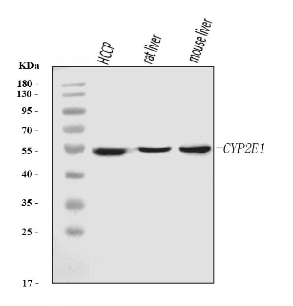 1 - Anti-Cytochrome P450 2E1/CYP2E1 Antibody Picoband™ (monoclonal, 2C7G1) ABO16263