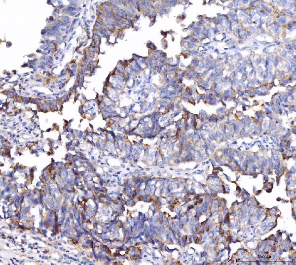 2 - Anti-CD55 Antibody Picoband™ (monoclonal, 5B9E1) ABO16265