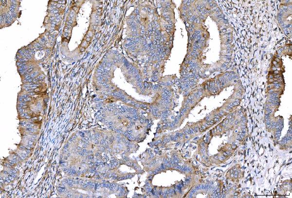 2 - Anti-CD55 Antibody Picoband™ (monoclonal, 5B9E1) ABO16265
