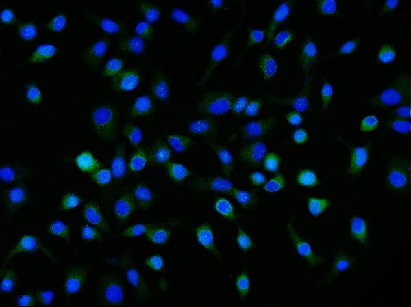 3 - Anti-Neuropilin 1 Antibody Picoband™ (monoclonal, 8G6G7) ABO16267