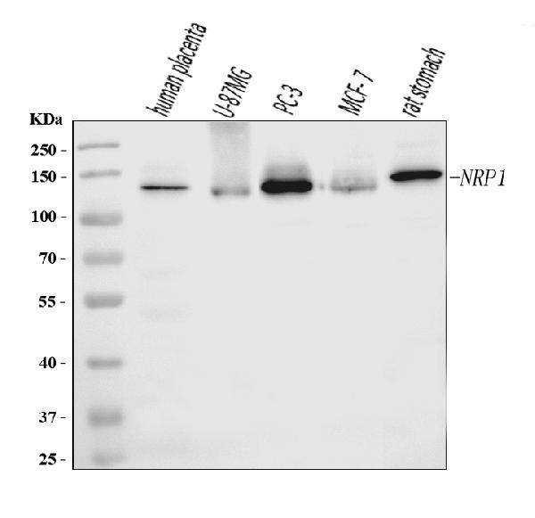 1 - Anti-Neuropilin 1 Antibody Picoband™ (monoclonal, 8G6G7) ABO16267