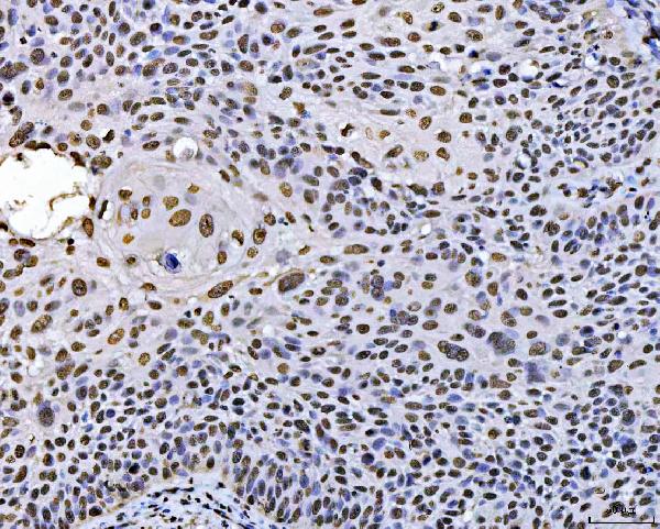 2 - Anti-PC4/SUB1 Antibody Picoband™ (monoclonal, 6B5B10) ABO16269