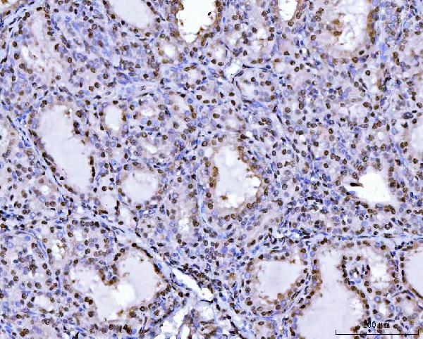 2 - Anti-PC4/SUB1 Antibody Picoband™ (monoclonal, 6B5B10) ABO16269