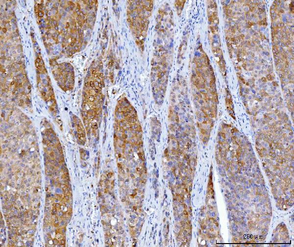 2 - Anti-HGD Antibody Picoband™ (monoclonal, 2F11E1) ABO16270
