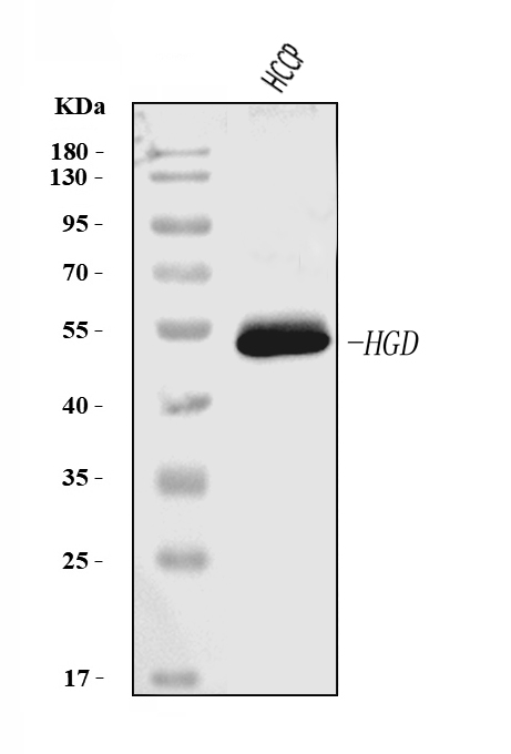 1 - Anti-HGD Antibody Picoband™ (monoclonal, 2F11E1) ABO16270