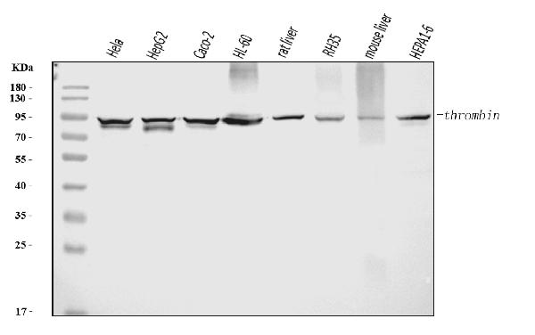 1 - Anti-Prothrombin Antibody Picoband™ (monoclonal, 5B6G1) ABO16271