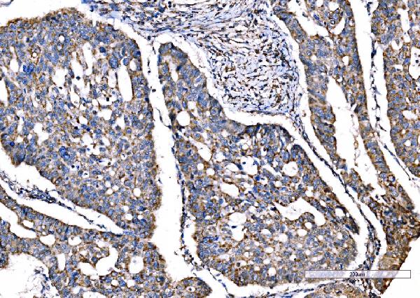 2 - Anti-SOD2 Antibody Picoband™ (monoclonal, 2B12B1) ABO16272