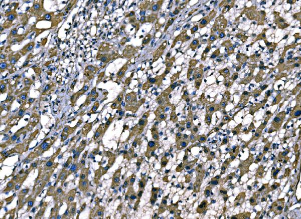 2 - Anti-SOD2 Antibody Picoband™ (monoclonal, 2B12B1) ABO16272