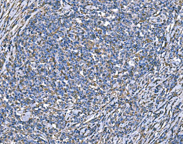 2 - Anti-SOD2 Antibody Picoband™ (monoclonal, 2B12B1) ABO16272