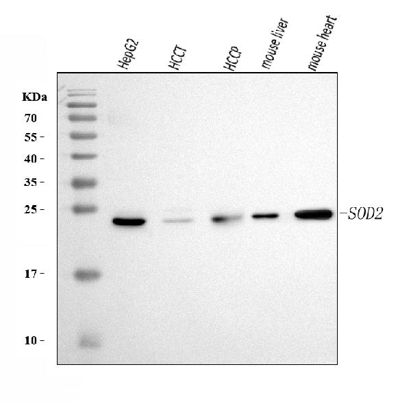 1 - Anti-SOD2 Antibody Picoband™ (monoclonal, 2B12B1) ABO16272