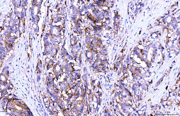 2 - Anti-Poliovirus Receptor/PVR Antibody Picoband™ (monoclonal, 9B9F1) ABO16273