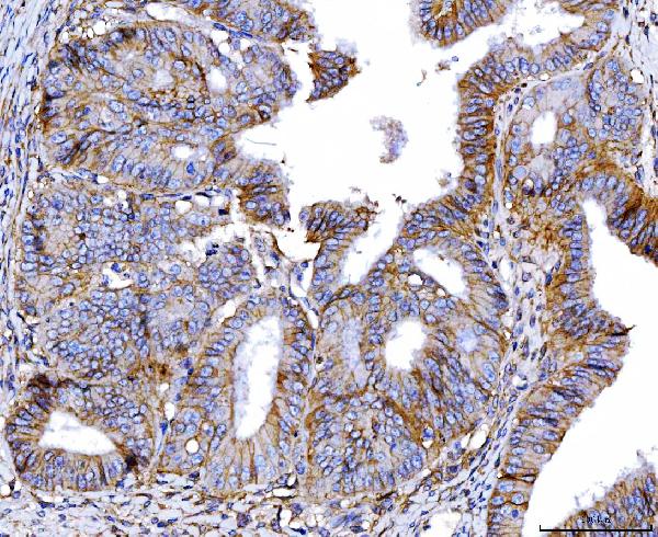 2 - Anti-Poliovirus Receptor/PVR Antibody Picoband™ (monoclonal, 9B9F1) ABO16273