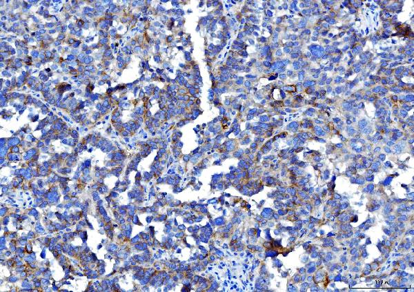 2 - Anti-Poliovirus Receptor/PVR Antibody Picoband™ (monoclonal, 9B9F1) ABO16273
