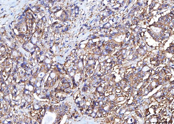 2 - Anti-Poliovirus Receptor/PVR Antibody Picoband™ (monoclonal, 5I13D1) ABO16274