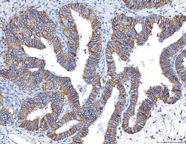 2 - Anti-Poliovirus Receptor/PVR Antibody Picoband™ (monoclonal, 5I13D1) ABO16274