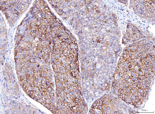 2 - Anti-Poliovirus Receptor/PVR Antibody Picoband™ (monoclonal, 5I13D1) ABO16274