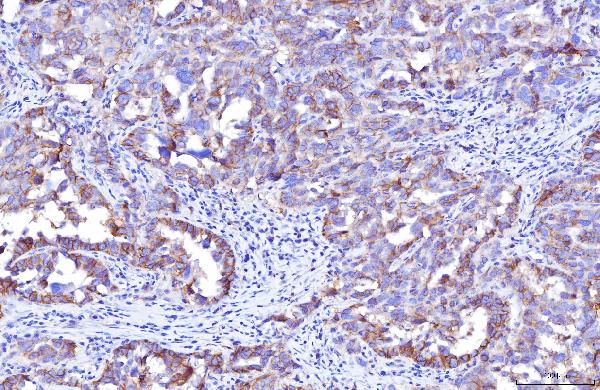 2 - Anti-Poliovirus Receptor/PVR Antibody Picoband™ (monoclonal, 5I13D1) ABO16274