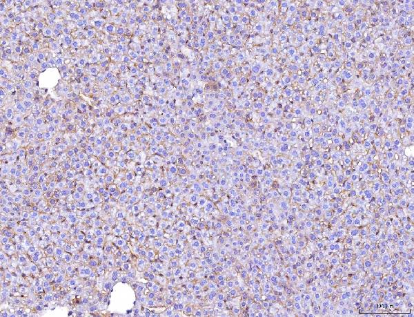2 - Anti-Poliovirus Receptor/PVR Antibody Picoband™ (monoclonal, 5I13D1) ABO16274