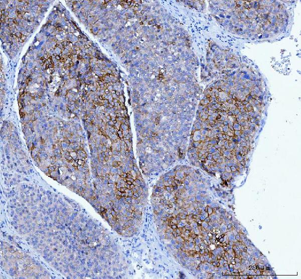 2 - Anti-Poliovirus Receptor/PVR Antibody Picoband™ (monoclonal, 3B11E9) ABO16275