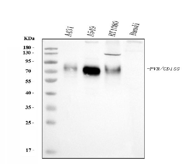 1 - Anti-Poliovirus Receptor/PVR Antibody Picoband™ (monoclonal, 3B11E9) ABO16275