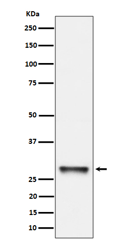 1 - Anti-PNMT Rabbit Monoclonal Antibody ABO16276