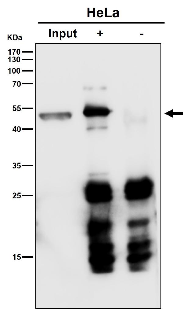 1 - Anti-P2Y12 Rabbit Monoclonal Antibody ABO16281