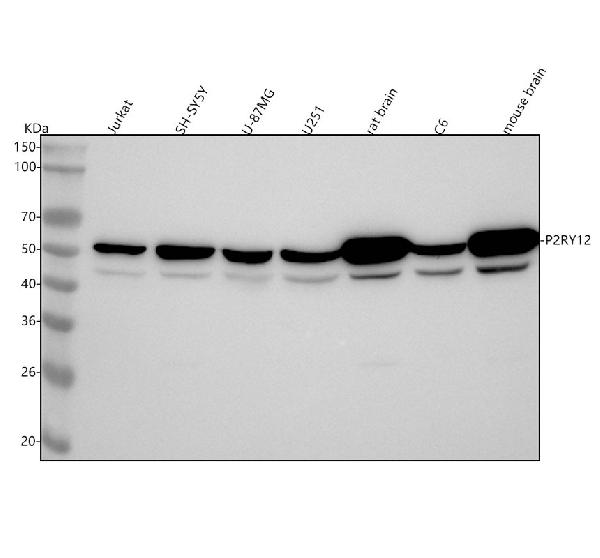 1 - Anti-P2Y12 Rabbit Monoclonal Antibody ABO16281