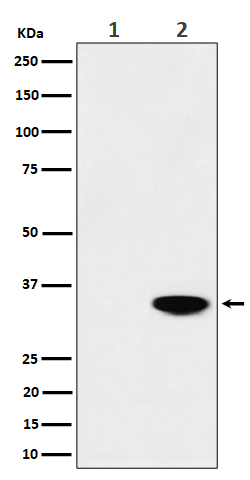 1 - Anti-Phospho-Nucleophosmin (T199) Rabbit Monoclonal Antibody ABO16282