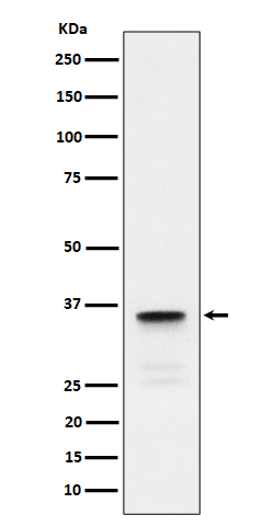 1 - Anti-Lactate Dehydrogenase C Rabbit Monoclonal Antibody ABO16285