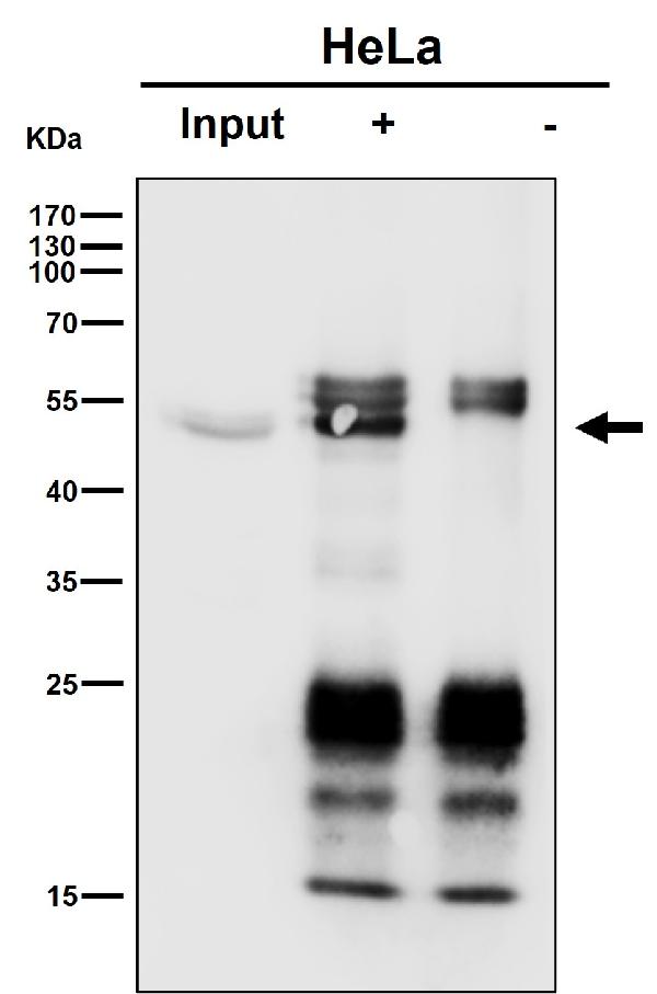 1 - Anti-HIF Prolyl Hydroxylases Rabbit Monoclonal Antibody ABO16286