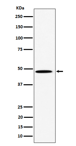 1 - Anti-HIF Prolyl Hydroxylases Rabbit Monoclonal Antibody ABO16286