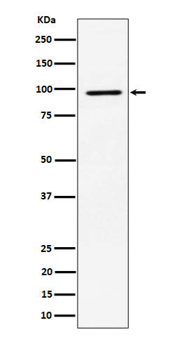 1 - Anti-RSK2 / RPS6KA3 Rabbit Monoclonal Antibody ABO16288