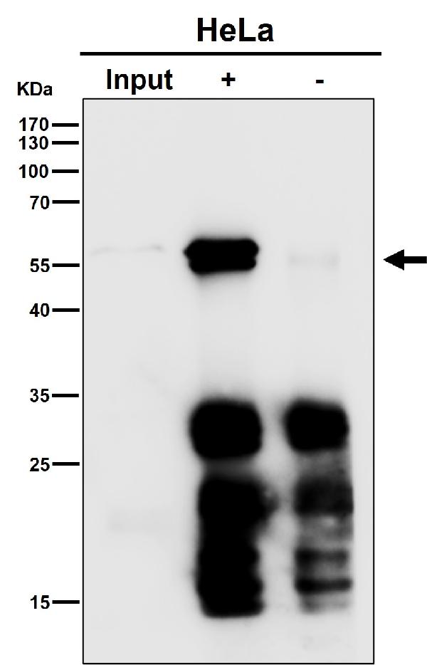 1 - Anti-ICAM2 / CD102 Rabbit Monoclonal Antibody ABO16291