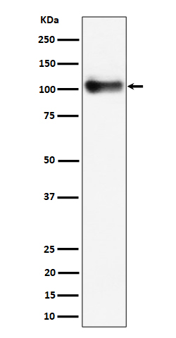 1 - Anti-Thrombomodulin / CD141 Rabbit Monoclonal Antibody ABO16292
