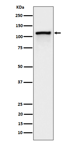 1 - Anti-Phospho-CBL (Y774) Rabbit Monoclonal Antibody ABO16293