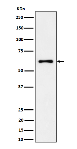 1 - Anti-EYA2 Rabbit Monoclonal Antibody ABO16295