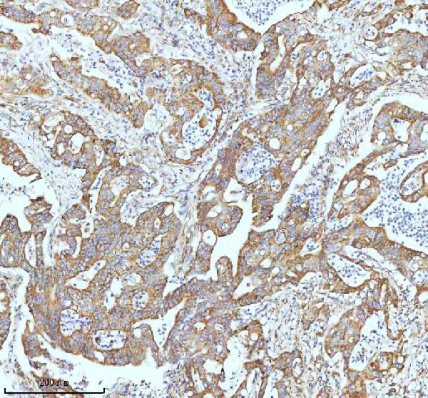 2 - Anti-GCLM Rabbit Monoclonal Antibody ABO16299